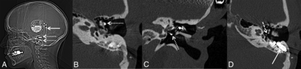FIG 12.