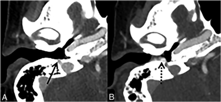 FIG 13.