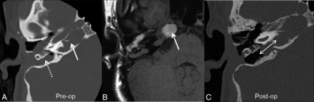 FIG 14.
