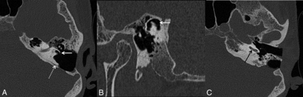 FIG 4.