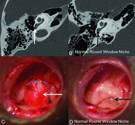 FIG 6.