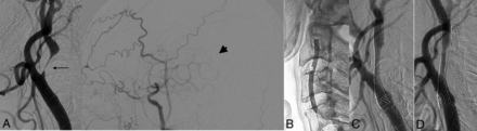 FIG 1.