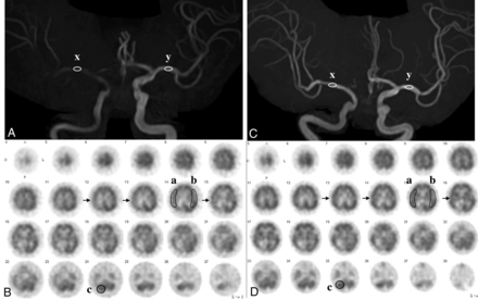 FIG 2.