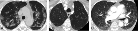FIG 1.