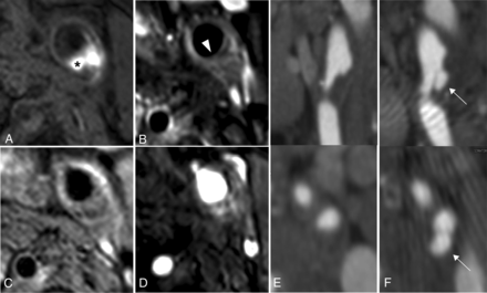 FIG 2.