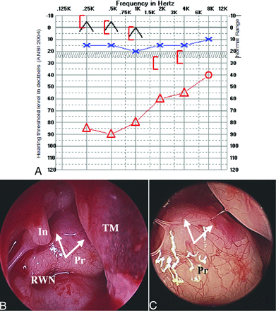 FIG 1.