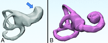 FIG 2.