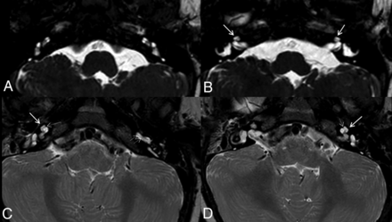FIG 3.