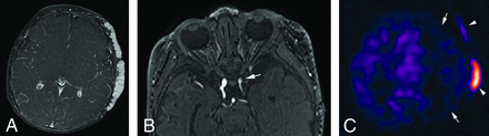 FIG 2.