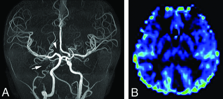 FIG 3.