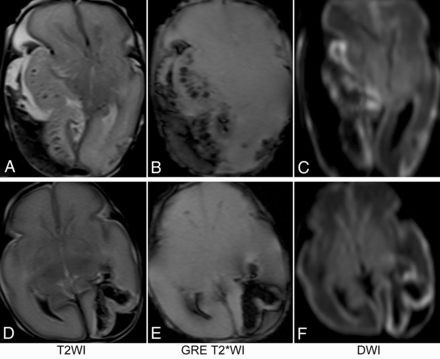 FIG 1.