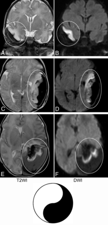 FIG 3.