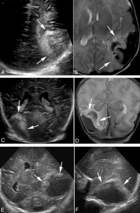 FIG 4.