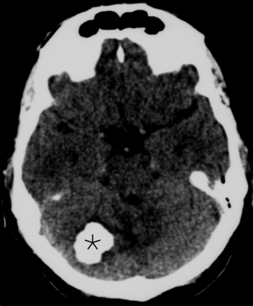 FIG 1.