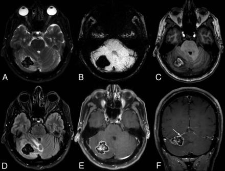 FIG 2.