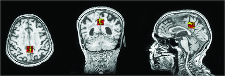 FIG 1.