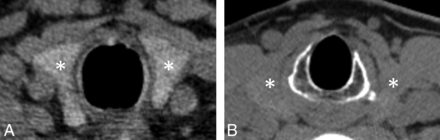 FIG 1.