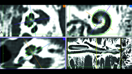 FIG 1.