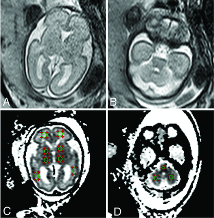 FIG 1.