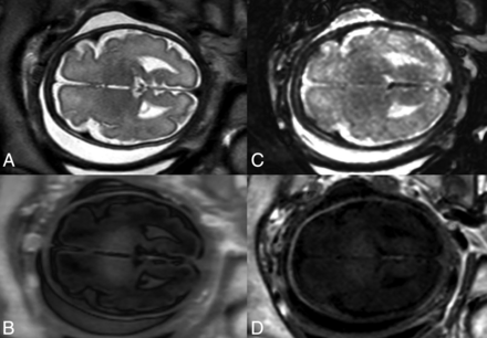 FIG 1.