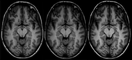 FIG 5.