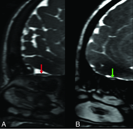 FIG 10.