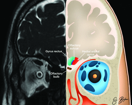 FIG 2.
