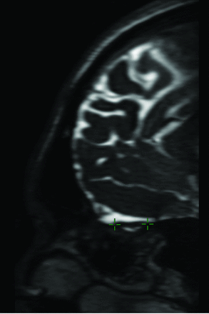 FIG 4.