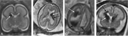 FIG 1.