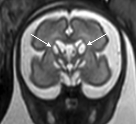 FIG 2.