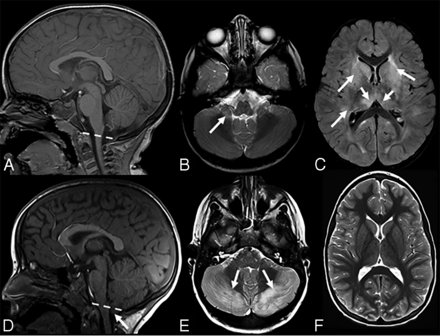 FIG 6.