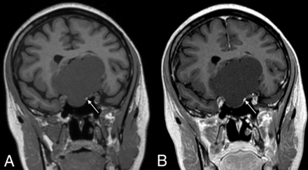FIG 3.