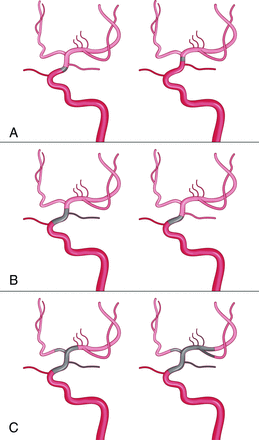 FIG 1.