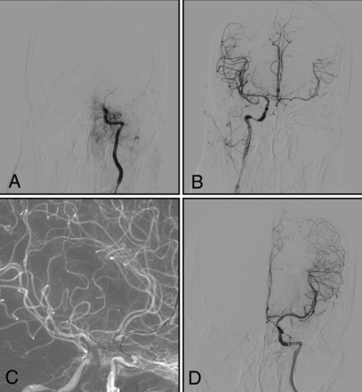 FIG 3.
