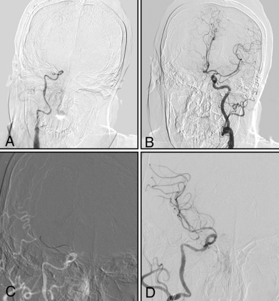 FIG 4.