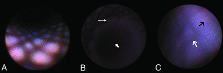 FIG 2.