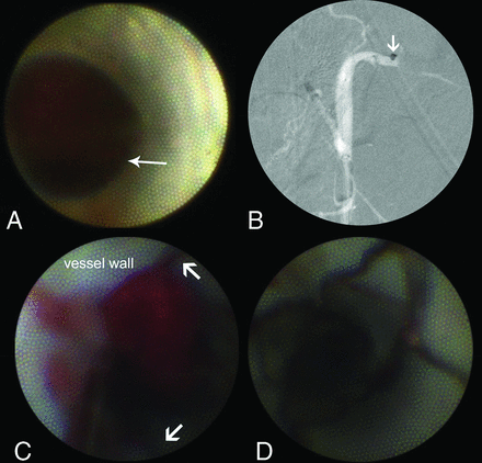 FIG 3.