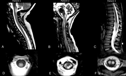 FIG 2.