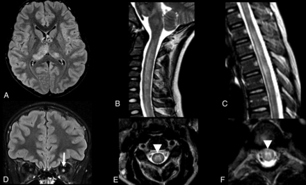 FIG 4.