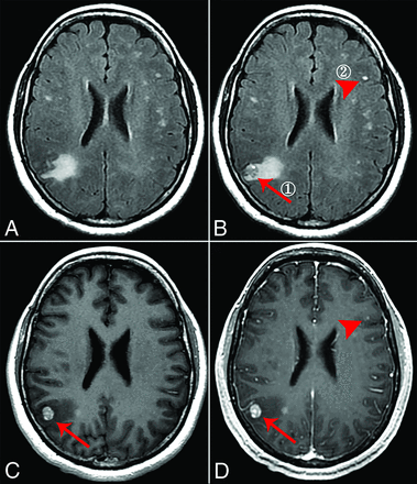 FIG 4.