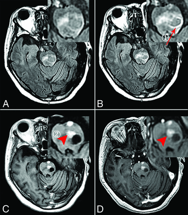 FIG 5.
