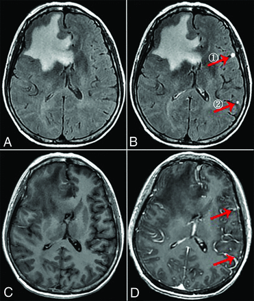 FIG 6.