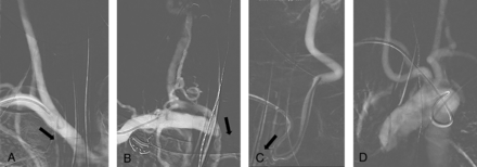 FIG 2.