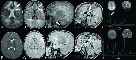 FIG 2.