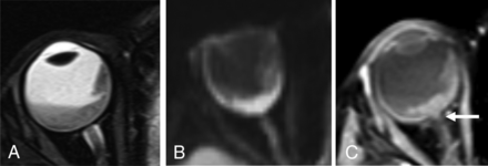 FIG 4.