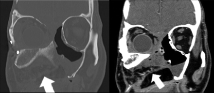 FIG 2.