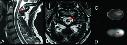 FIG 2.