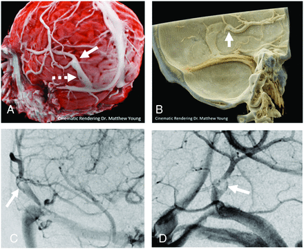 FIG 2.