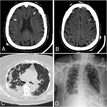 FIG 2.