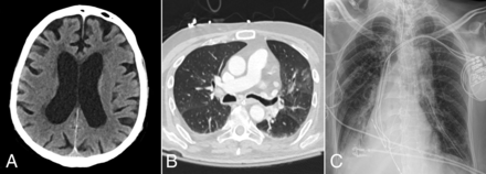 FIG 4.